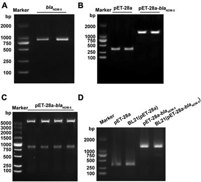 The effects of NDM-5 on Escherichia coli and the screening of interacting proteins